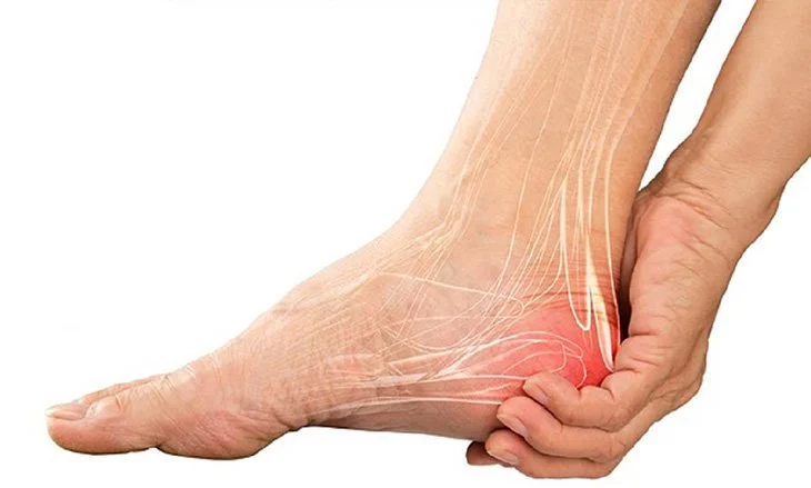 Viêm gân gót chân có nguy hiểm không? 