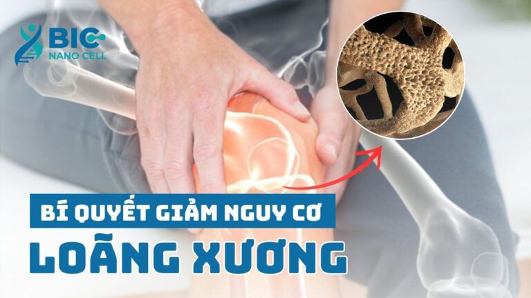 Bí quyết giảm nguy cơ loãng xương 30 tuổi BIC NANO CELL