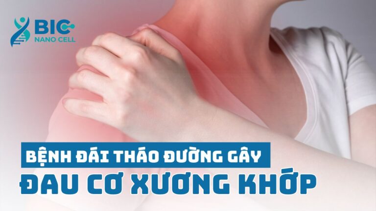 Bệnh đái tháo đường gây đau cơ xương khớp BIC NANO CELL