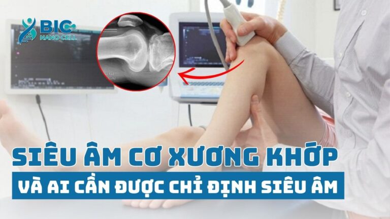 Siêu âm cơ xương khớp là gì? và những ai cần được chỉ định siêu âm BIC NANO CELL