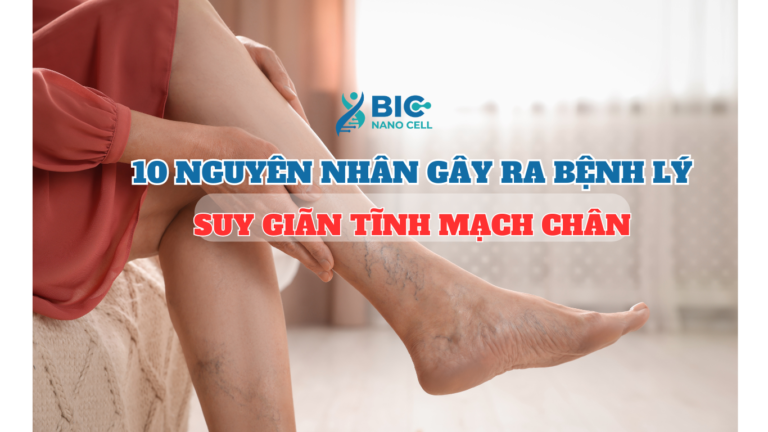 10 nguyên nhân gây ra bệnh lý suy giãn tĩnh mạch