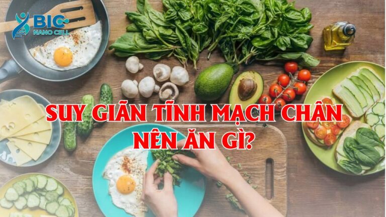 Suy giãn tĩnh mạch chân nên ăn gì? Bic Nano Cell