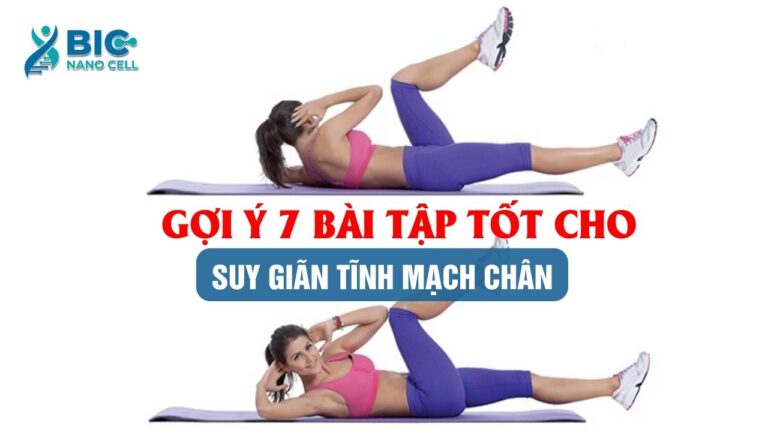 Bài tập tốt cho suy giãn tĩnh mạch chân Bic Nano Cell