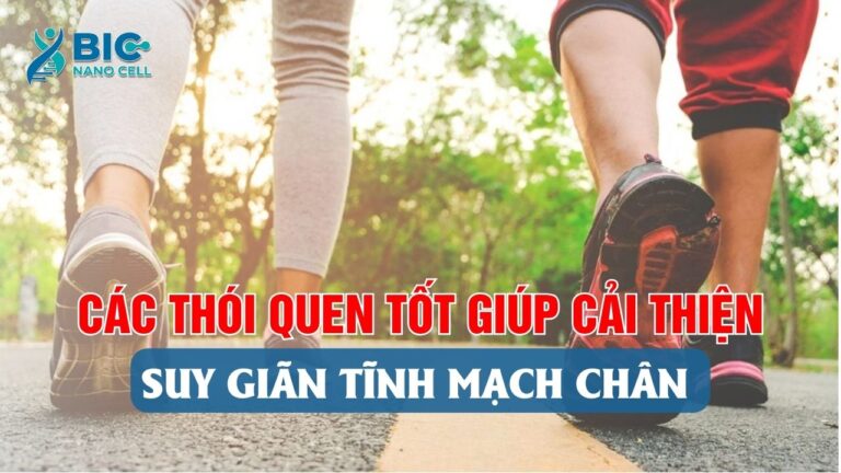 Thói quen tốt cải thiện suy giãn tĩnh mạch bic nano cell