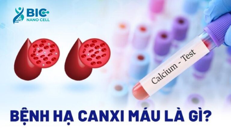 Bệnh hạ canxi máu là gì? Bic Nano Cell