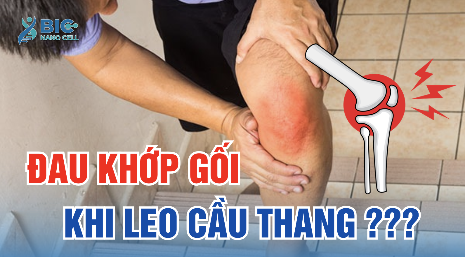 Đau khớp gối khi leo cầu thang là dấu hiệu gì BIC NANO CELL
